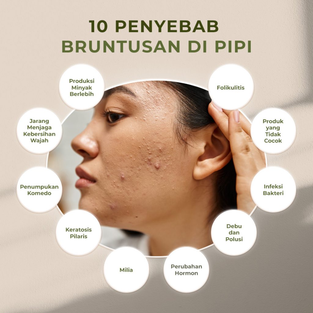 penyebab-bruntusan-di-pipi